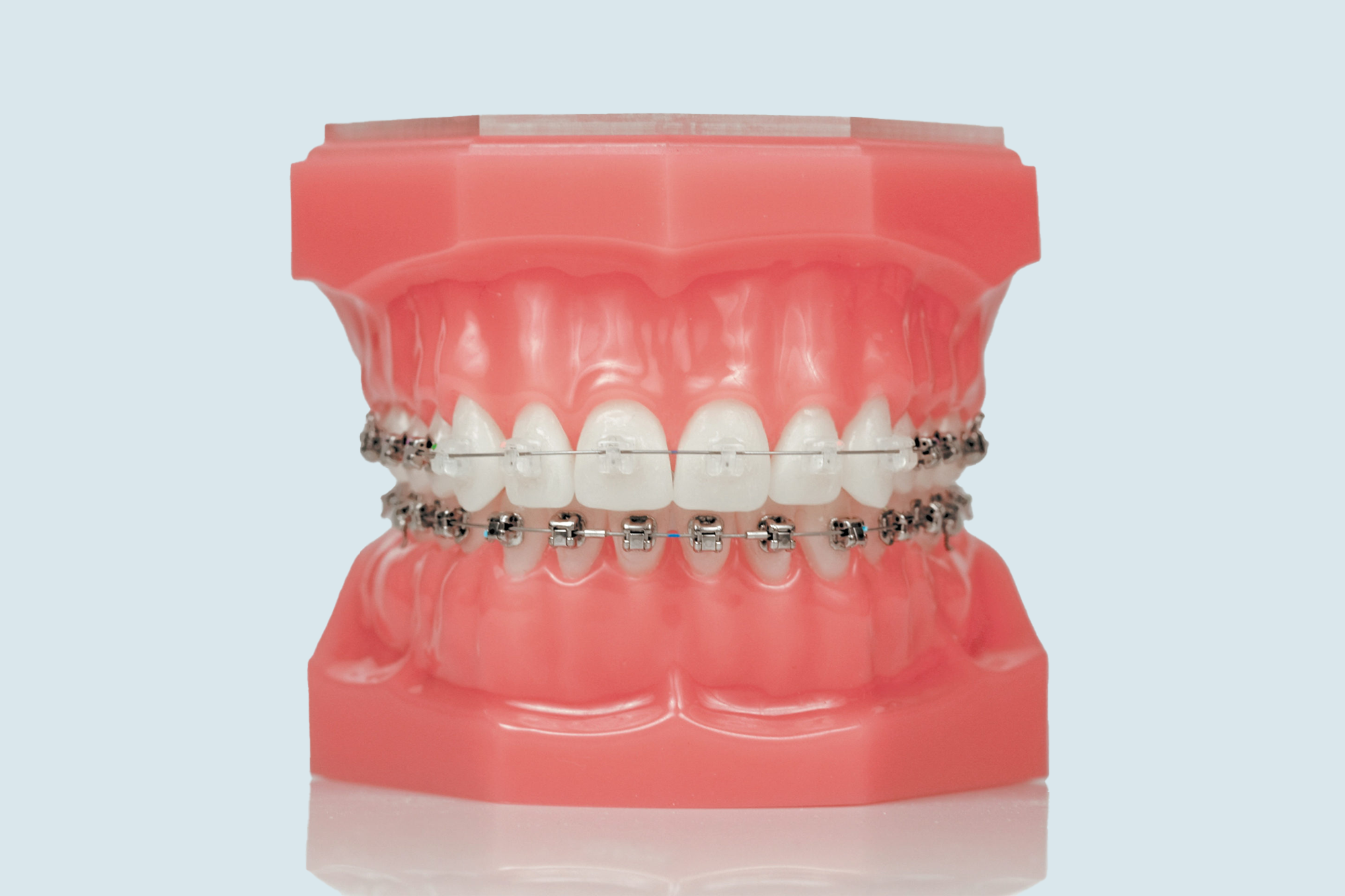 clear braces typodont