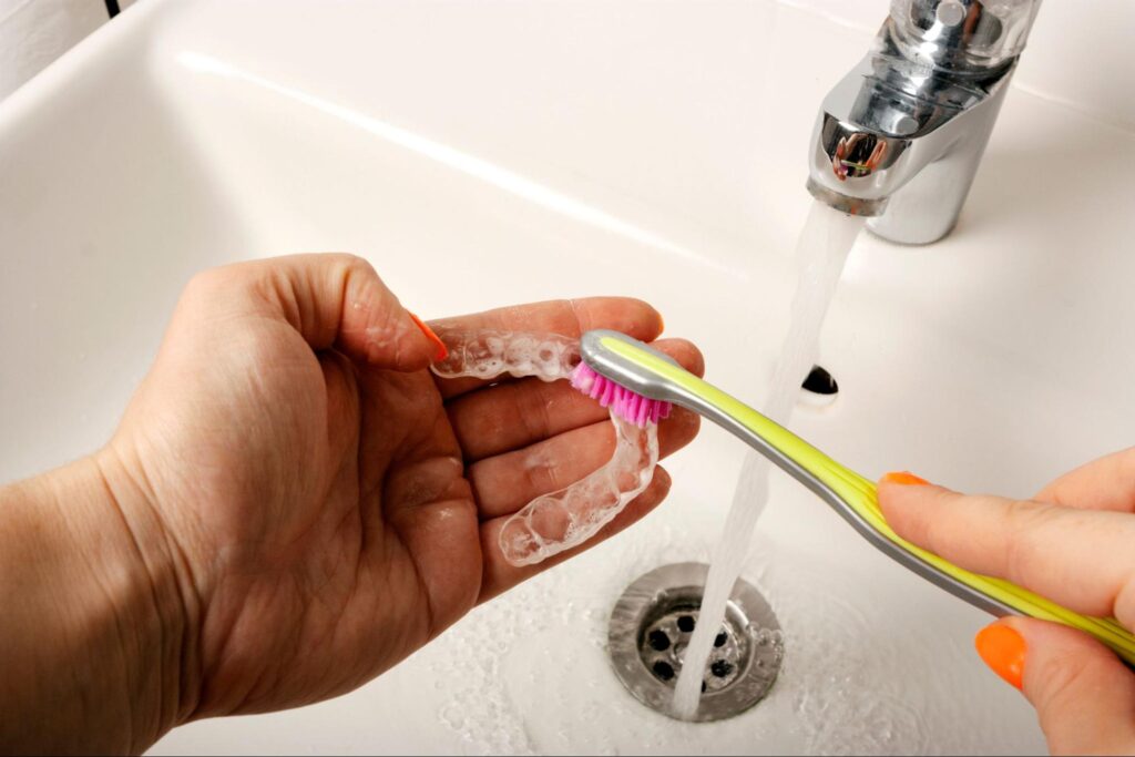 Everything You Need to Know About Retainers