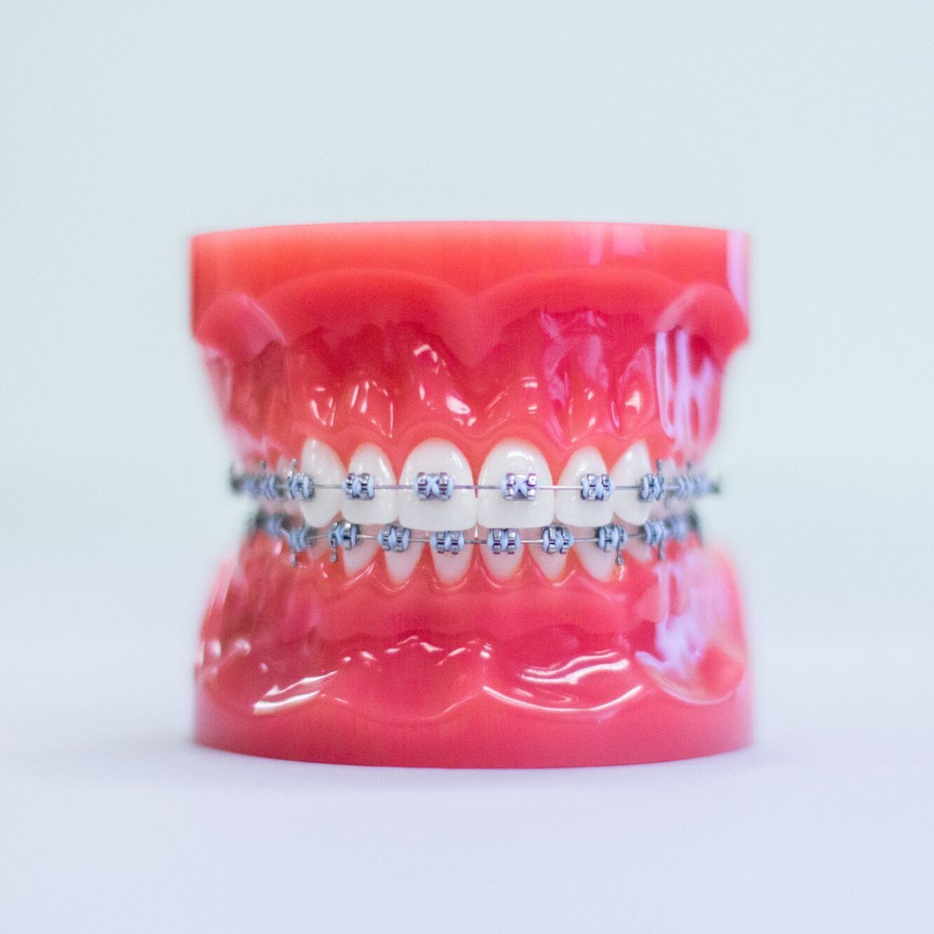 Metal braces model used in orthodontic treatment in Stephenville