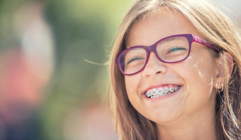Patient wearing metal braces during orthodontic treatment in Weatherford