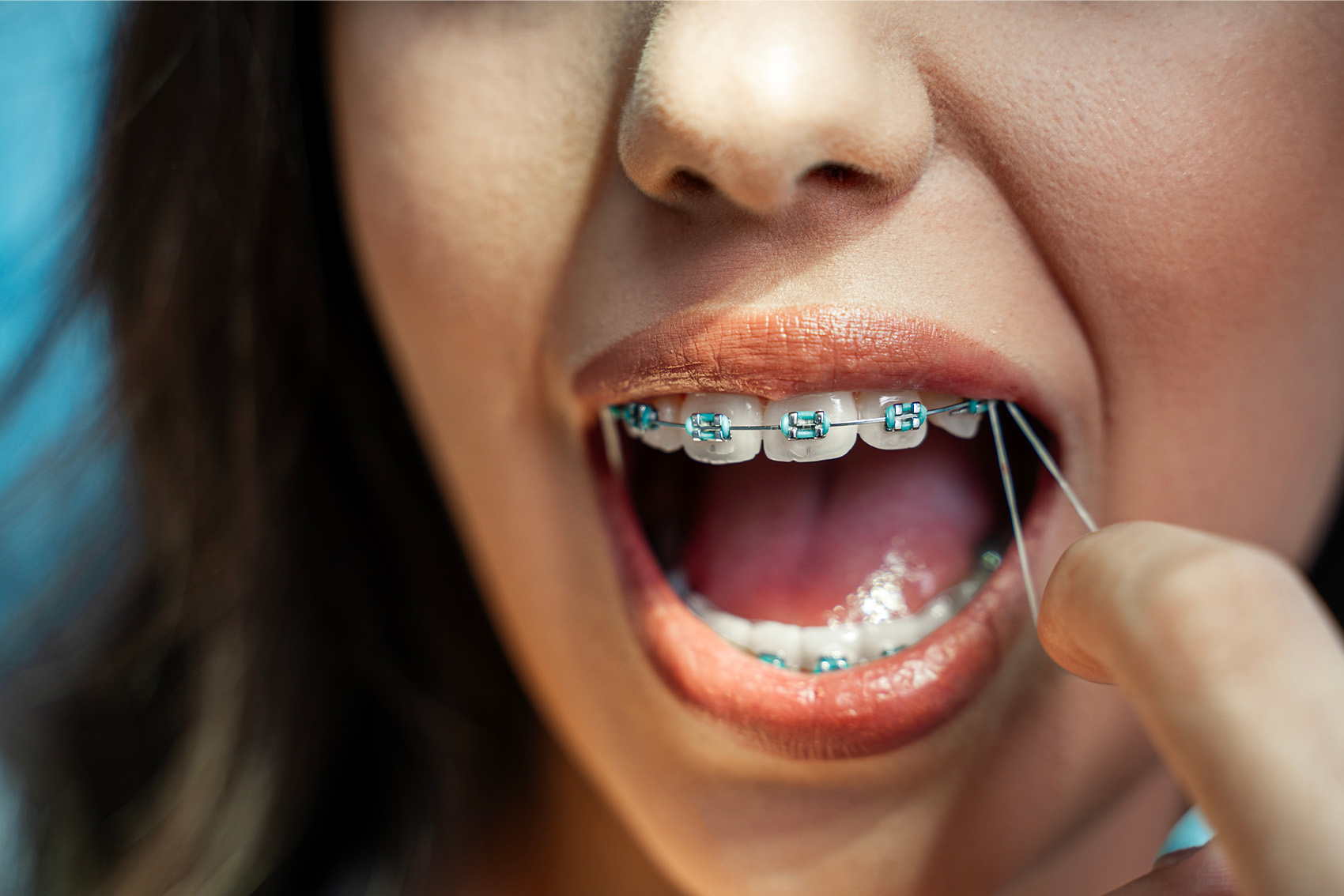 A woman with braces demonstrates proper oral care.
